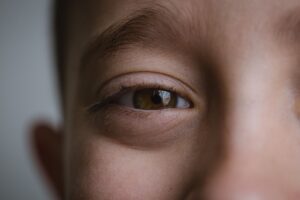 子供が目を細める原因は視力に関係しているのか？